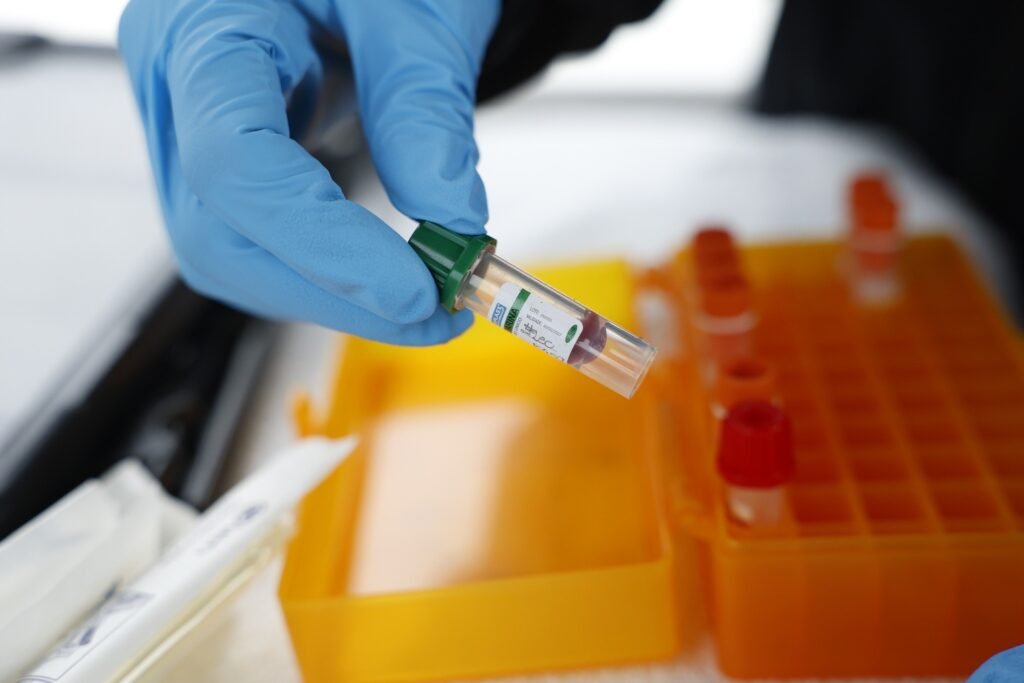 doenças infecciosas: Uma mão com luva azul segura um tubo de ensaio com amostra de sangue e tampa verde em laboratório.